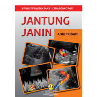 Prinsip Pemeriksaan Ultrasonografi Jantung Janin