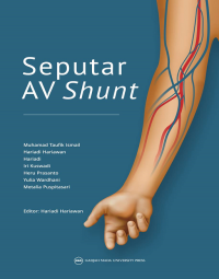 Seputar Av Shunt